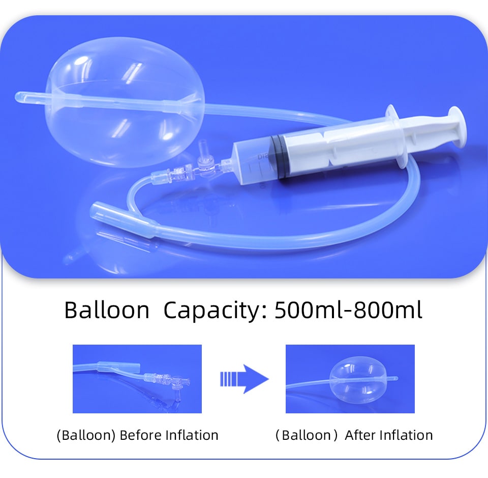 Postpartum Hemostatic Balloon