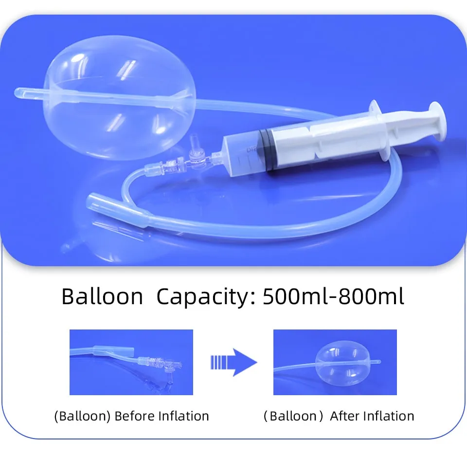 postpartum hemostatic balloon