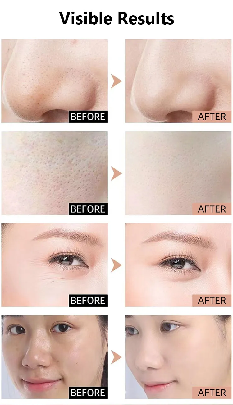 visiable results of silicone led face masks